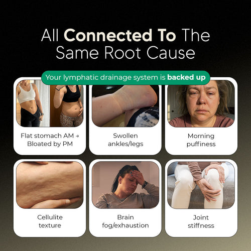 New Maximum Potency Formula - Lymphatic Drainage Capsules by Floriem™