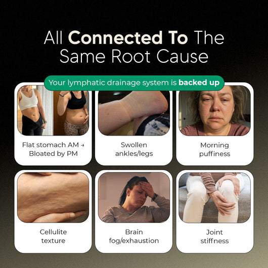 New Maximum Potency Formula - Lymphatic Drainage Capsules by Floriem™