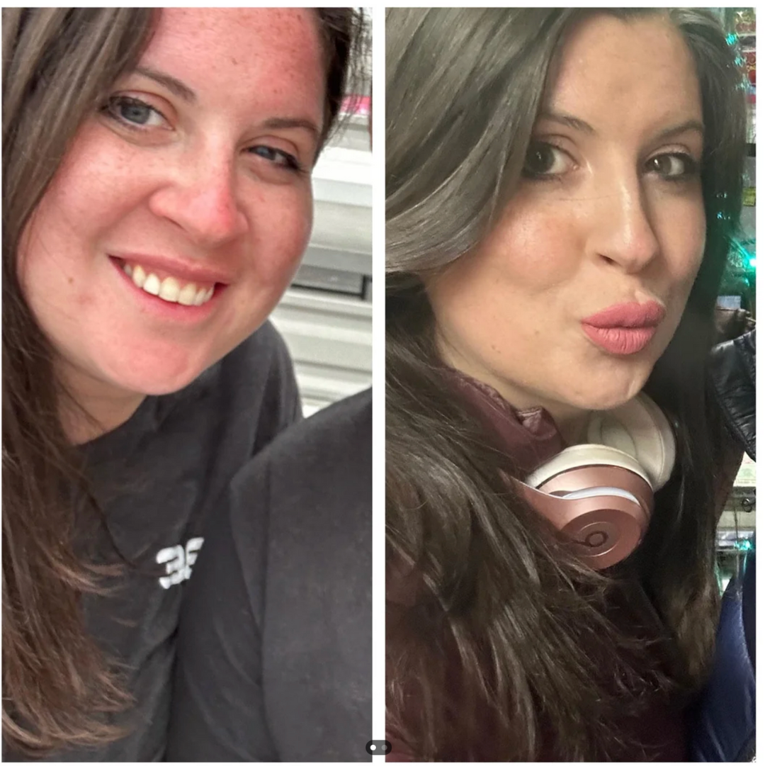 21 Years of Puffiness—Gone in Weeks