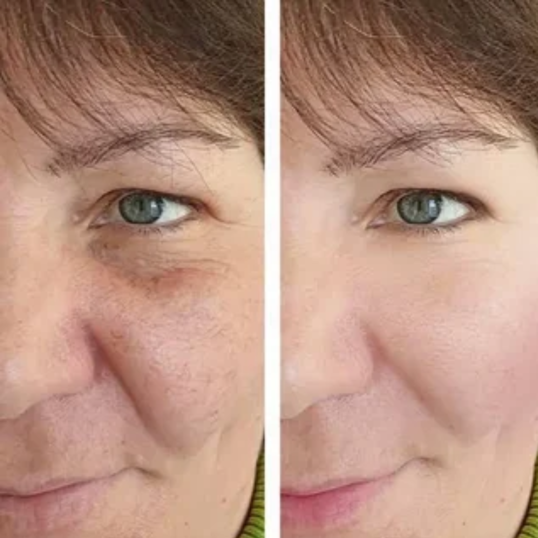 From Puffy to Sculpted — Without Harsh Tools