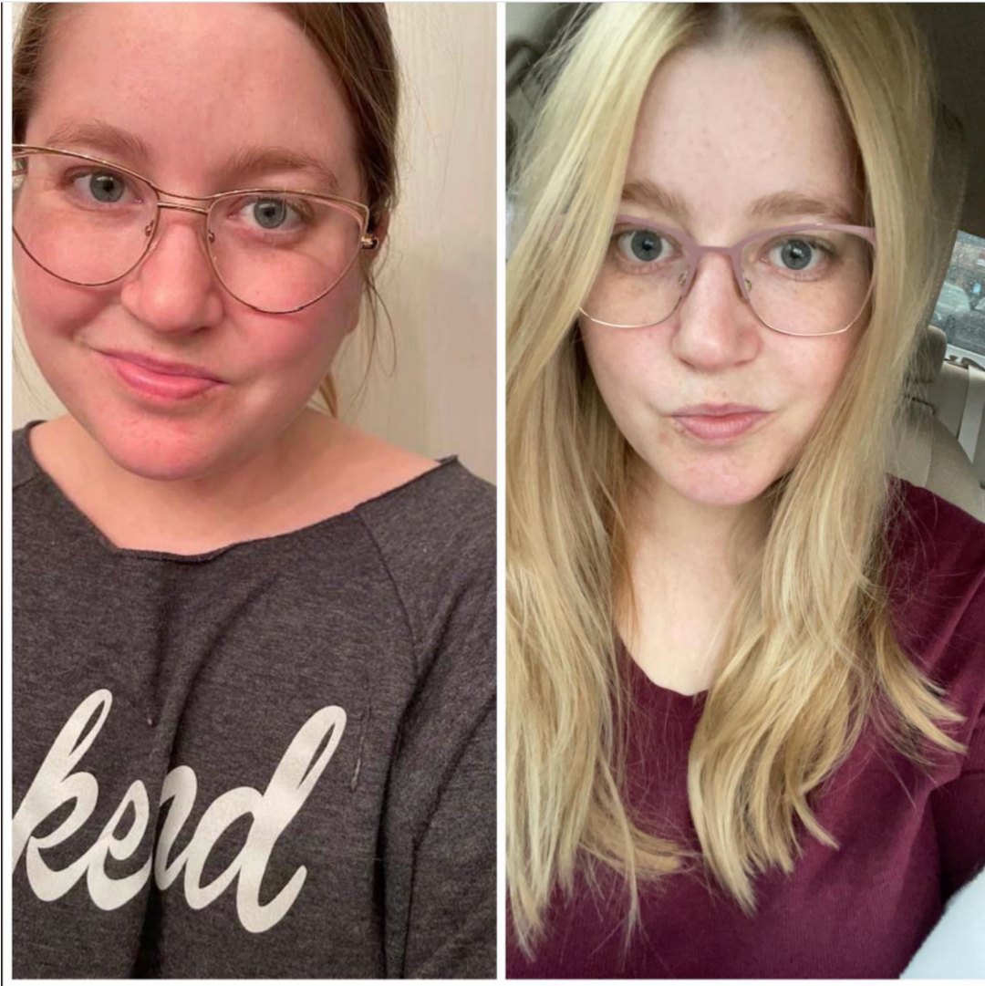 I didn’t realize how much my skin was dragging my face down…